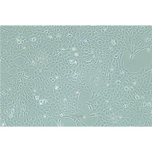 人整合SV40基因的乳腺上皮细胞HBL-100