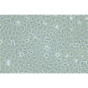 人整合SV40基因的乳腺上皮细胞HBL-100