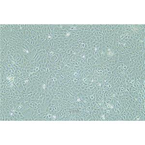 人整合SV40基因的乳腺上皮细胞HBL-100