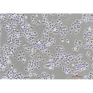 人支气管上皮细胞HBE135-E6E7(STR鉴定) | EnkiLife恩玑生命