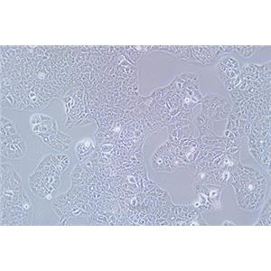 人子宫颈表皮癌细胞MS751(STR鉴定) | EnkiLife恩玑生命