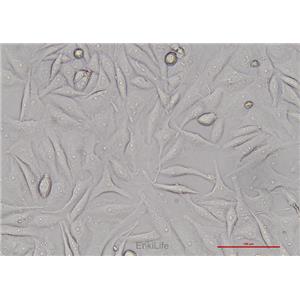 人子宫颈鳞癌细胞SiHa