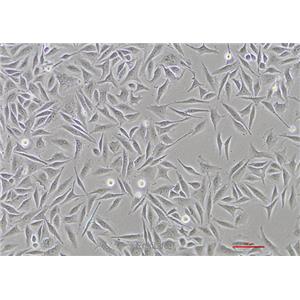 人子宫颈鳞癌细胞SiHa