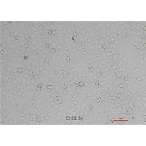 人子宫颈上皮细胞永生化