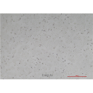 人子宫颈上皮细胞永生化