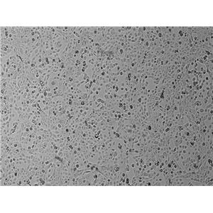 人子宫鳞癌细胞(高分化)HCC-94