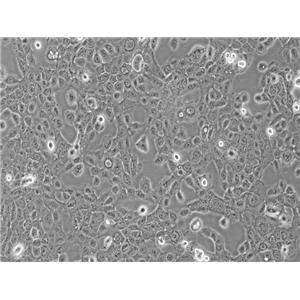 人子宫鳞癌细胞(高分化)HCC-94