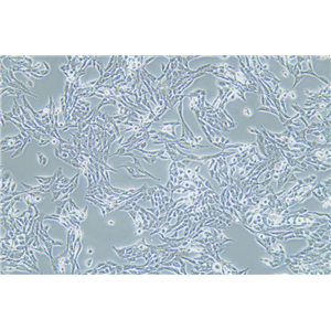 人子宫鳞状癌细胞SW756(STR鉴定) | EnkiLife恩玑生命