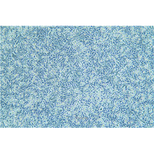 小鼠膀胱癌细胞稳定表达荧光素酶MB49+LUC