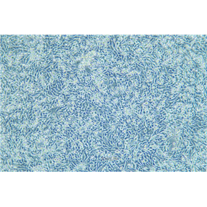 小鼠膀胱癌细胞稳定表达荧光素酶MB49+LUC