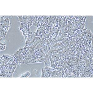 小鼠垂体瘤细胞GT1-1