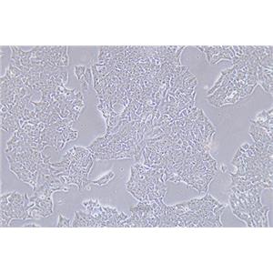 小鼠垂体瘤细胞GT1-1