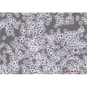 小鼠单核巨噬细胞J774A.1