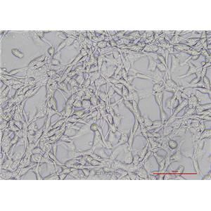 小鼠结肠癌细胞CT26.CL25