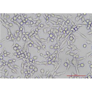 小鼠结肠癌细胞MC38