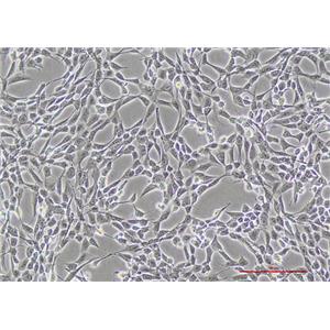 小鼠胚胎成纤维细胞NIH/3T3