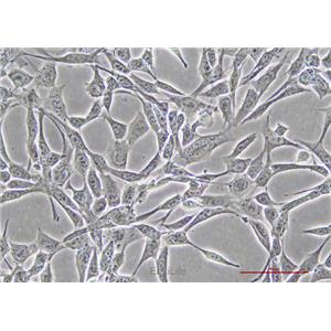 小鼠胚胎成纤维细胞NIH/3T3