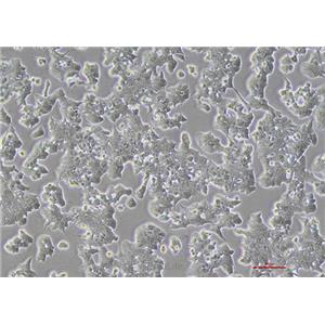 小鼠胰岛β细胞MIN6