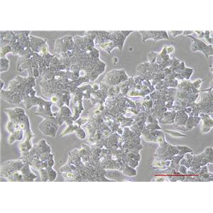 小鼠胰岛β细胞MIN6