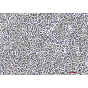 小鼠胰岛内皮细胞MS-1