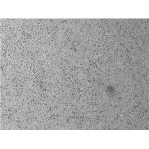 小鼠杂交瘤（抗CD2）细胞OKT11