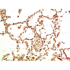 Acetyl-NF-KB p65 (Lys314/Lys315) (6D6)鼠单抗,Acetyl-NF-KB p65 (Lys314/Lys315) (6D6) Mouse Monoclonal Antibody