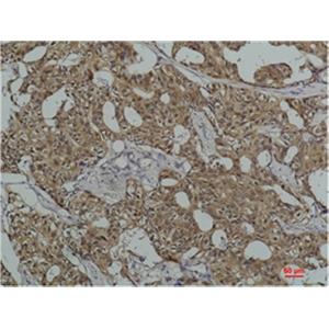 Hsc70 (5C2)鼠单抗,Hsc70 (5C2) Mouse Monoclonal Antibody