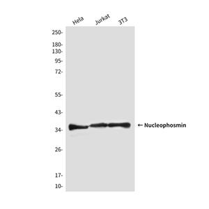 Nucleophosmin (2D9)鼠单抗,Nucleophosmin (2D9) Mouse Monoclonal Antibody
