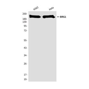 BRG1 (4E11)鼠单抗,BRG1 (4E11) Mouse Monoclonal Antibody