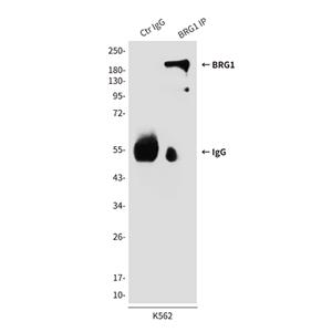 BRG1 (4E11)鼠单抗,BRG1 (4E11) Mouse Monoclonal Antibody