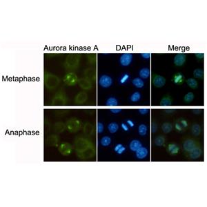 Aurora A (2E3)鼠单抗,Aurora A (2E3) Mouse Monoclonal Antibody