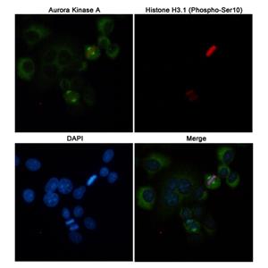 Aurora A (2E3)鼠单抗,Aurora A (2E3) Mouse Monoclonal Antibody