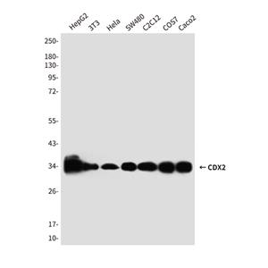 CDX2 (4B9)鼠单抗,CDX2 (4B9) Mouse Monoclonal Antibody