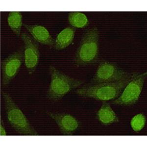 Smad2 (6H5)鼠单抗,Smad2 (6H5) Mouse Monoclonal Antibody