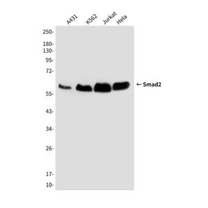 Smad2 (6H5)鼠单抗,Smad2 (6H5) Mouse Monoclonal Antibody