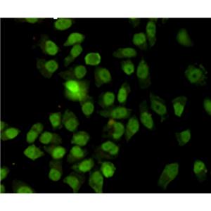 Ku70 (7B1)鼠单抗,Ku70 (7B1) Mouse Monoclonal Antibody