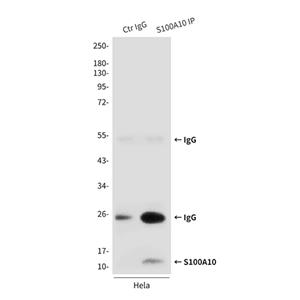 S100A10 (6F4)鼠单抗,S100A10 (6F4) Mouse Monoclonal Antibody