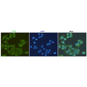 S100A10 (6F4)鼠单抗,S100A10 (6F4) Mouse Monoclonal Antibody