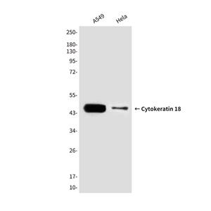 Cytokeratin 18 (6A8)鼠单抗,Cytokeratin 18 (6A8) Mouse Monoclonal Antibody
