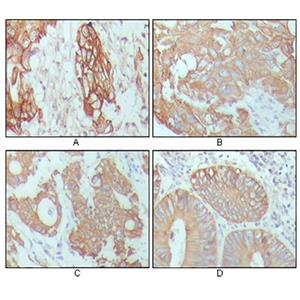 Cytokeratin 18 (6A8)鼠单抗,Cytokeratin 18 (6A8) Mouse Monoclonal Antibody