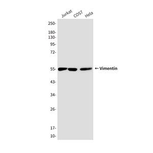 Vimentin (10E2)鼠单抗,Vimentin (10E2) Mouse Monoclonal Antibody