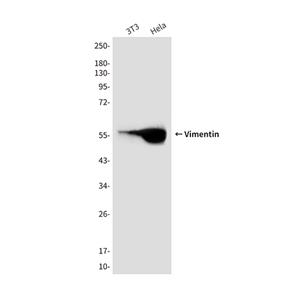 Vimentin (10E2)鼠单抗,Vimentin (10E2) Mouse Monoclonal Antibody