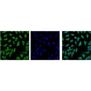 Hsp70 1A (1D9)鼠单抗,Hsp70 1A (1D9) Mouse Monoclonal Antibody