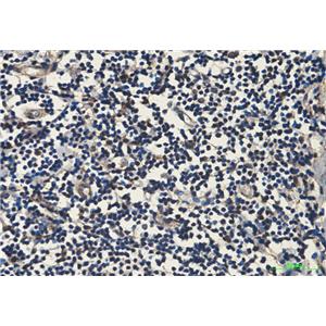 Hsp70 1A (1D9)鼠单抗,Hsp70 1A (1D9) Mouse Monoclonal Antibody