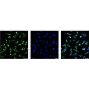 Peroxiredoxin 1 (6A6)鼠单抗,Peroxiredoxin 1 (6A6) Mouse Monoclonal Antibody
