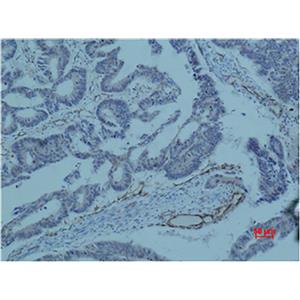 Survivin (8B9)鼠单抗,Survivin (8B9) Mouse Monoclonal Antibody