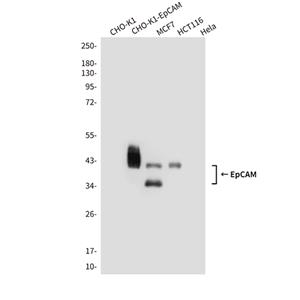 EpCAM (1D5)鼠单抗,EpCAM (1D5) Mouse Monoclonal Antibody