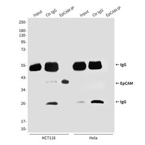 EpCAM (1D5)鼠单抗,EpCAM (1D5) Mouse Monoclonal Antibody