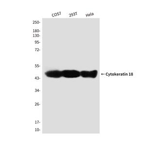 Cytokeratin 18 (2B5)鼠单抗,Cytokeratin 18 (2B5) Mouse Monoclonal Antibody
