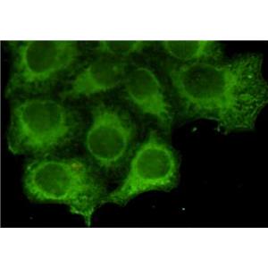 Cytokeratin 18 (2B5)鼠单抗,Cytokeratin 18 (2B5) Mouse Monoclonal Antibody